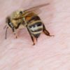 Bee and Wasp Stings > Symptoms | Treatment | Home remedies | When to call a doctor | Prevention