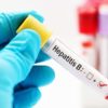 Hepatitis B > What is hepatitis B? | Causes | Transmission | Symptoms | Tests and diagnosis | Treatment | Prevention