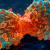 Cancer > What is cancer? | Causes | Treatments | Types | Outlook | Takeaway